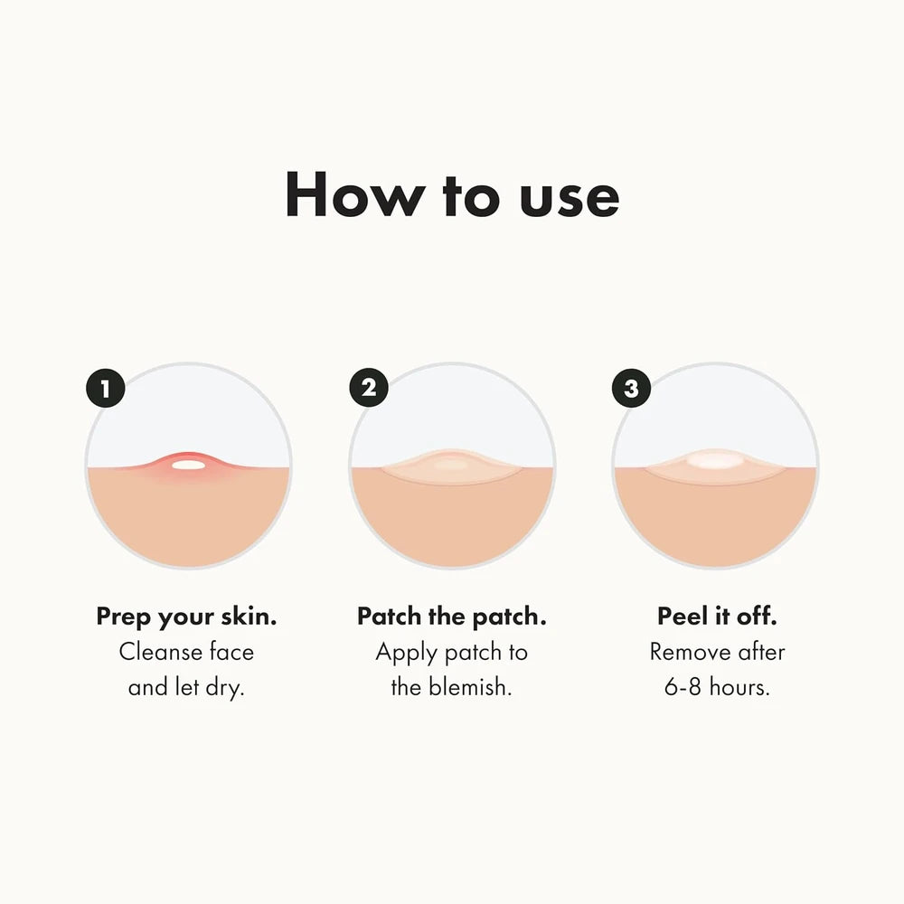 Mighty Patch Hydrocolloid Acne Pimple Patches